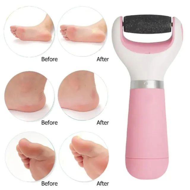 Lixa Elétrica de Pés Pedicure Esfoliador e Removedor de Calos e Rachadura Usb  - Foto 3