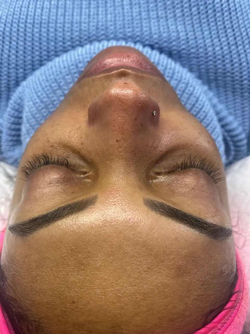Limpeza de pele profunda completa  - Foto 2