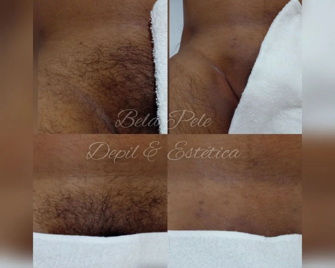 Depil e Estética FEM. / MAS.