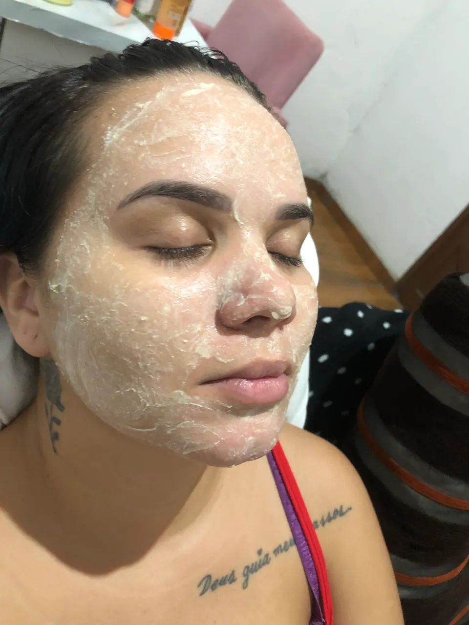 Limpeza de pele profunda  - Foto 2