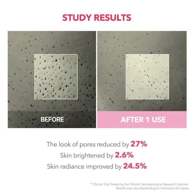 Máscara Noturna APRILSKIN - 99% de TXA de Alta Pureza - Foto 3
