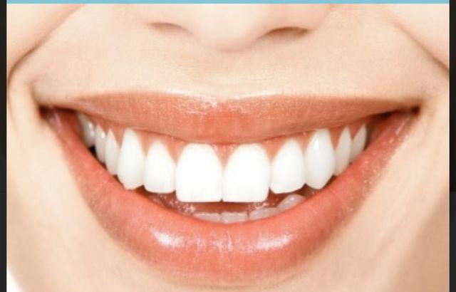 Vaga para Periodontista e Implantodontista