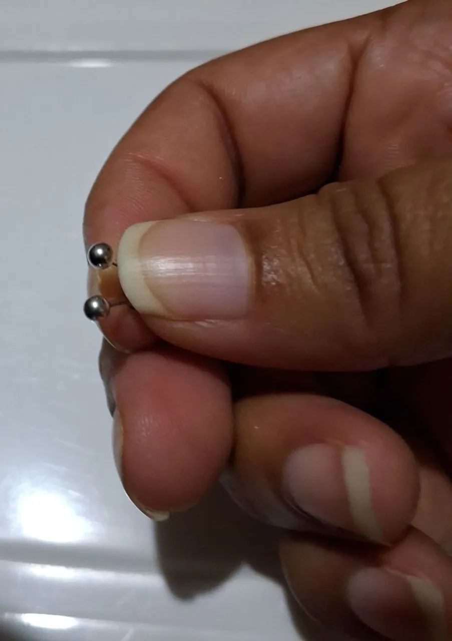 Brinco de Ouro - Foto 5