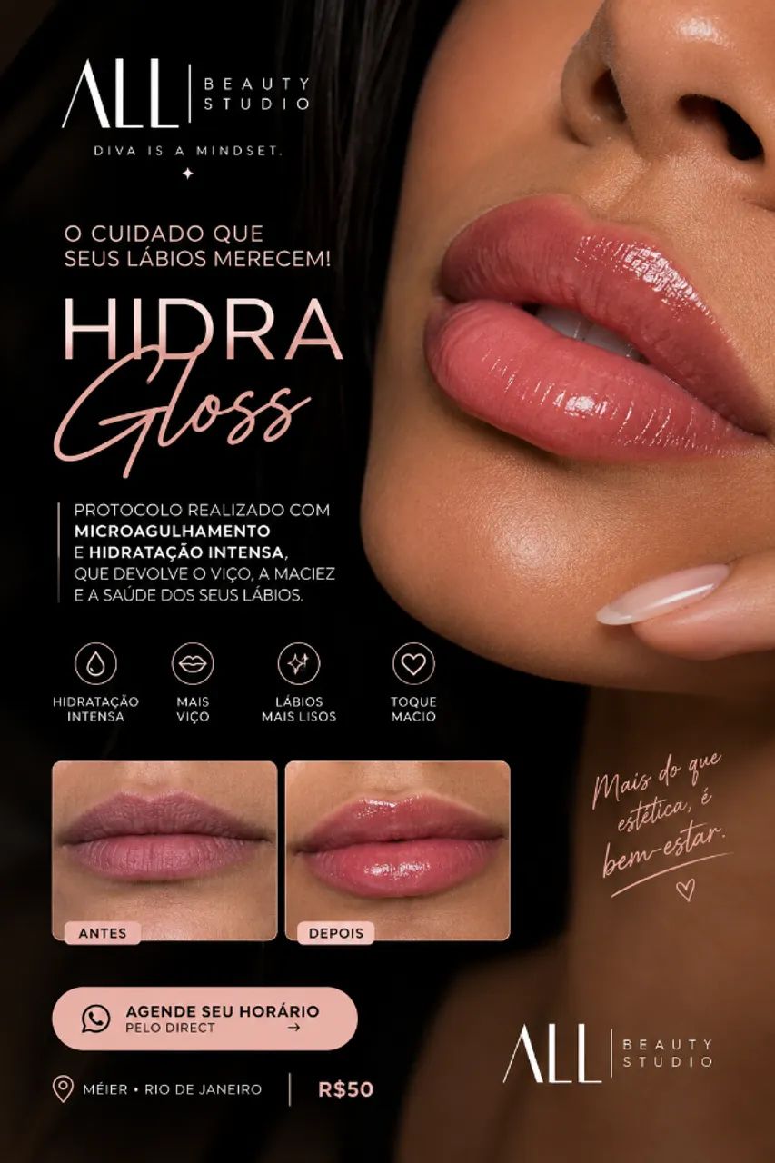 REVITALIZAÇÃO LABIAL