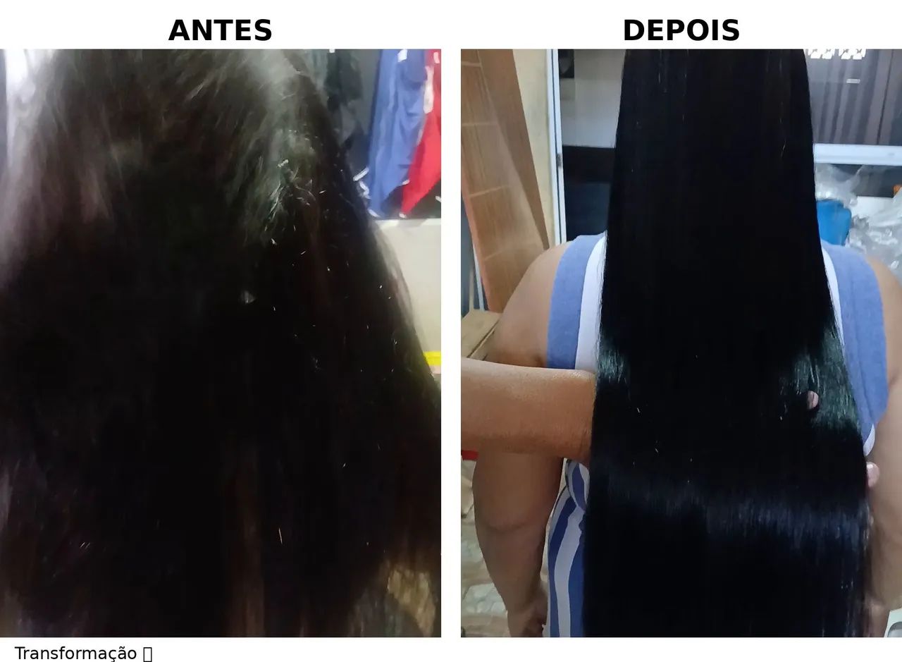 Selagem Led terapia a domicílio  - Foto 5