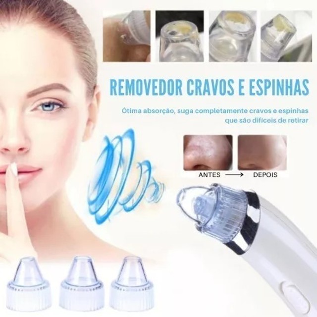 Aparelho Removedor Cravos e Espinhas 4 Em 1 Extrator Vácuo Pele Limpa - Novo - Foto 3