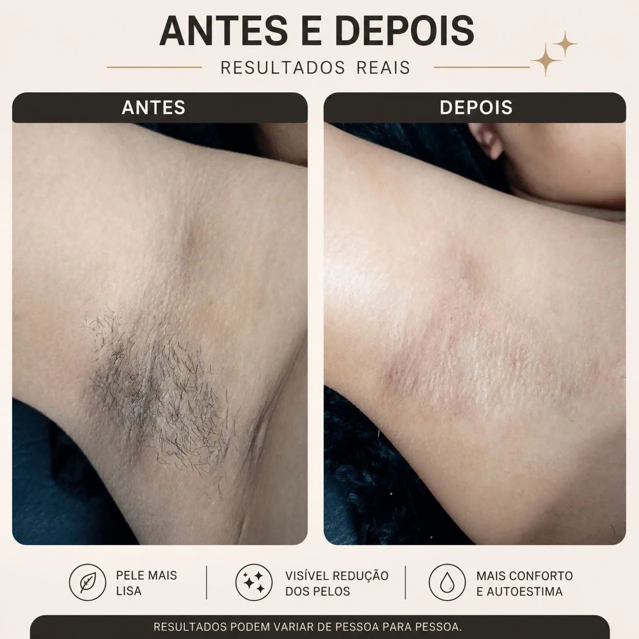 Depilação a cera,  sou Carol de Mauá abc