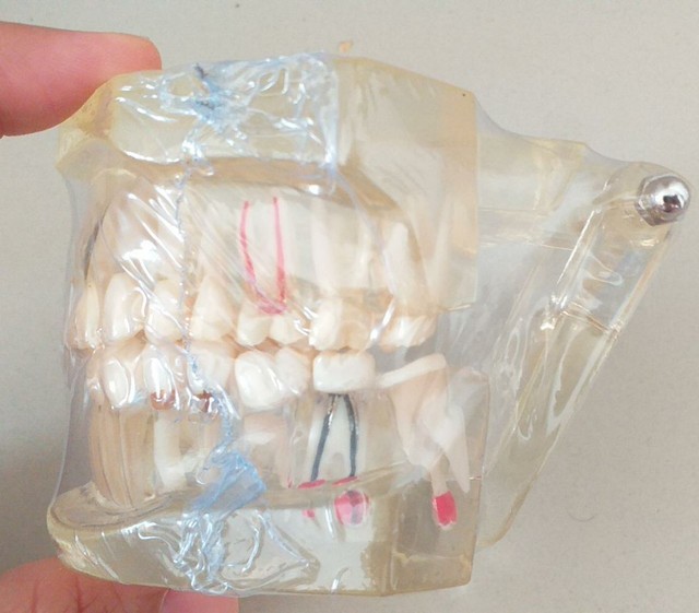 Modelo da arcada dentária - Odontologia - Foto 3