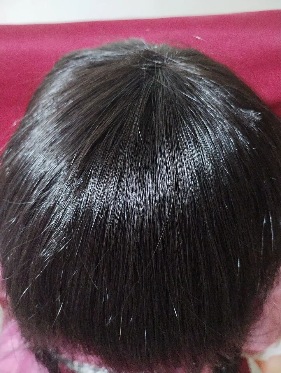 Top clourure frontal  cabelo brasileiro regional  - Foto 2