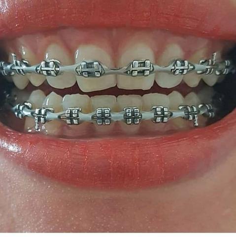 Planos Odontoserv e Odontoprev - Foto 2