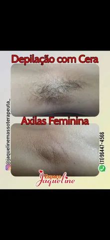 Depilação  homens e mulheres  - Foto 4