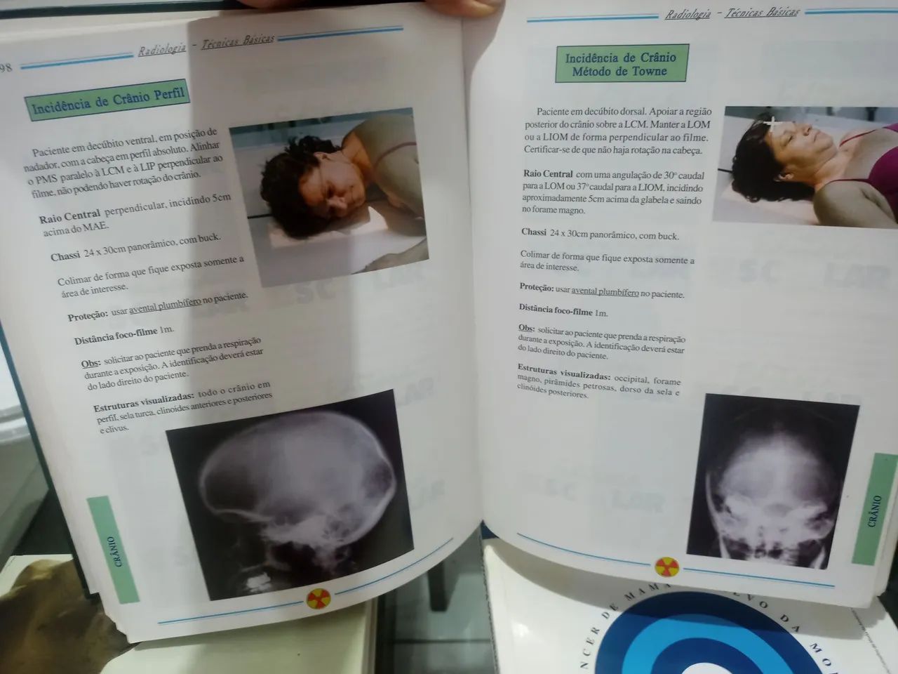 COMBO TRATADO DE RADIOLOGIA, MAMOGRAFIA E RADIOLOGIA TECNICAS PRATICAS - Foto 6