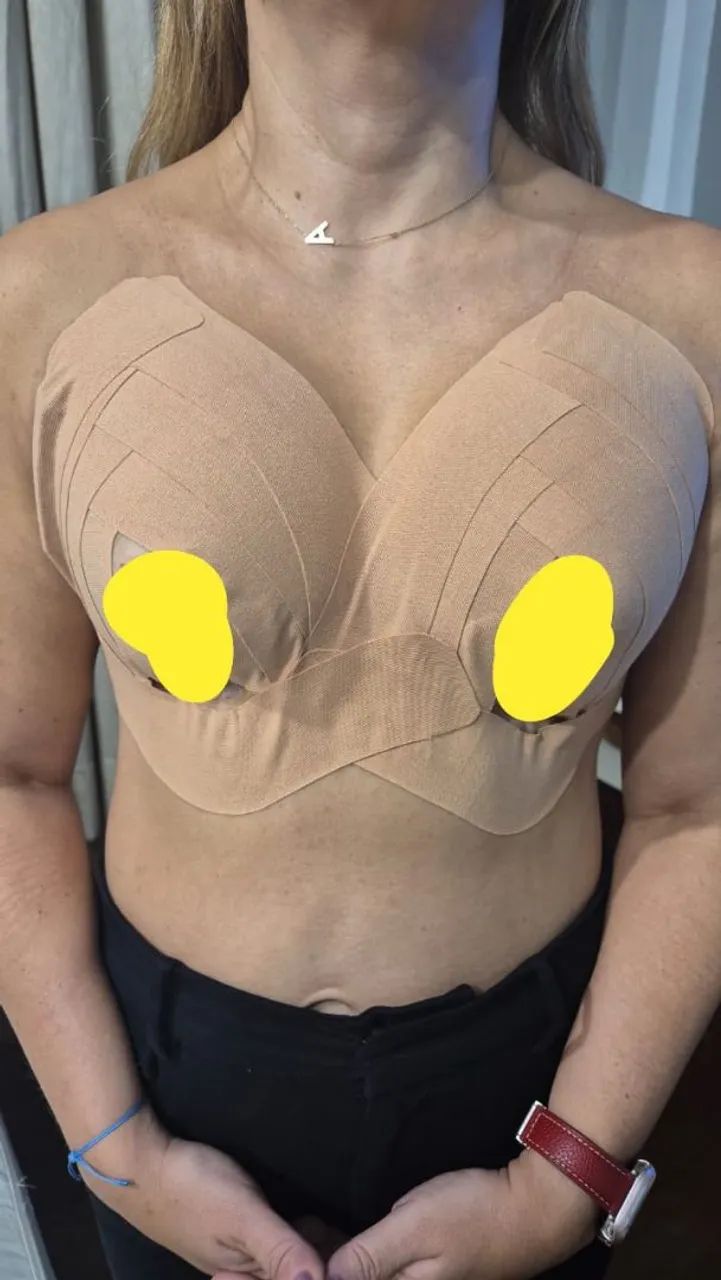 Pós-operatório de Cirurgia Plástica - Foto 3