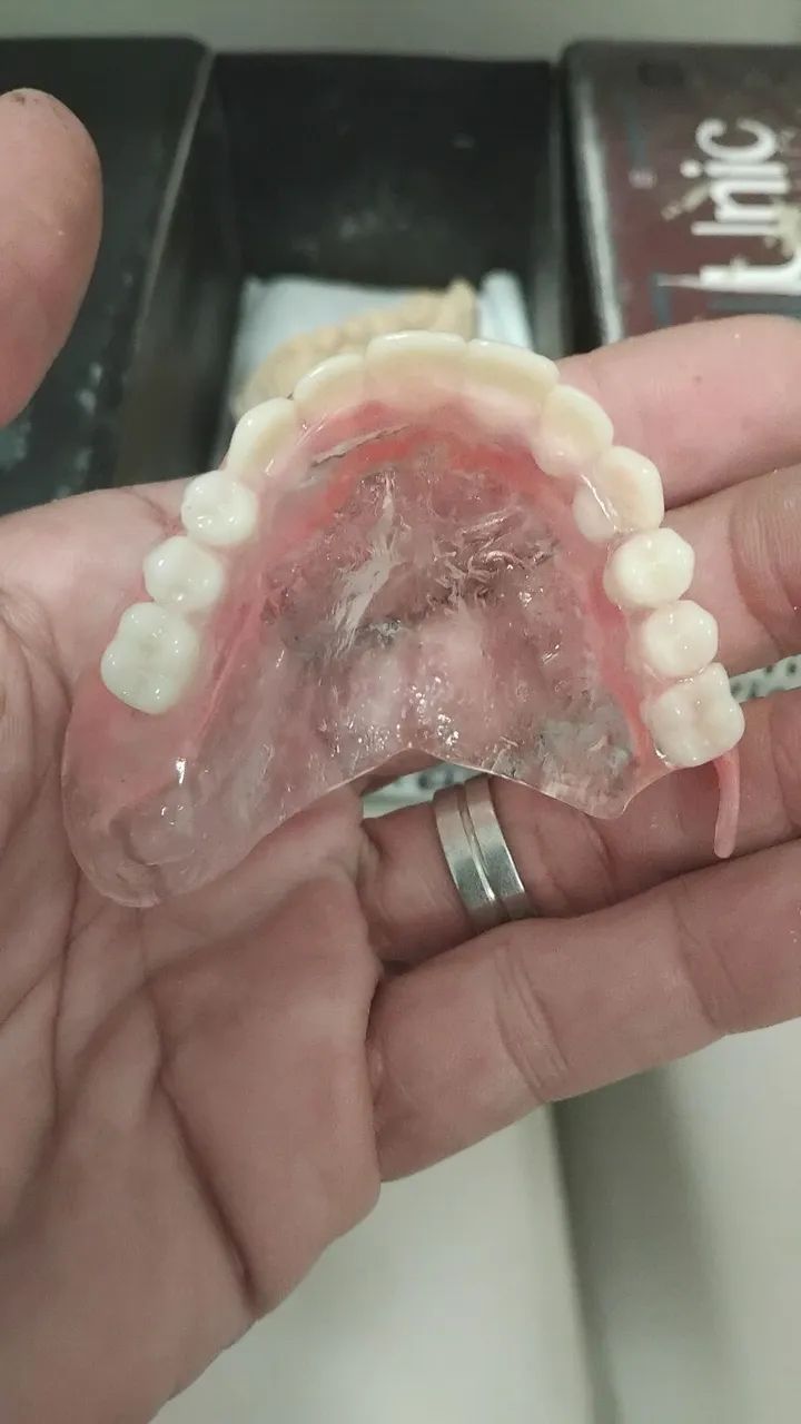 Prótese dentária  - Foto 2