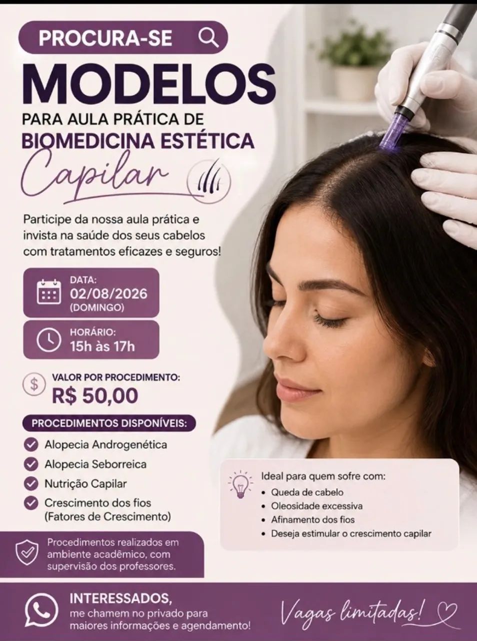 Procura-se modelos