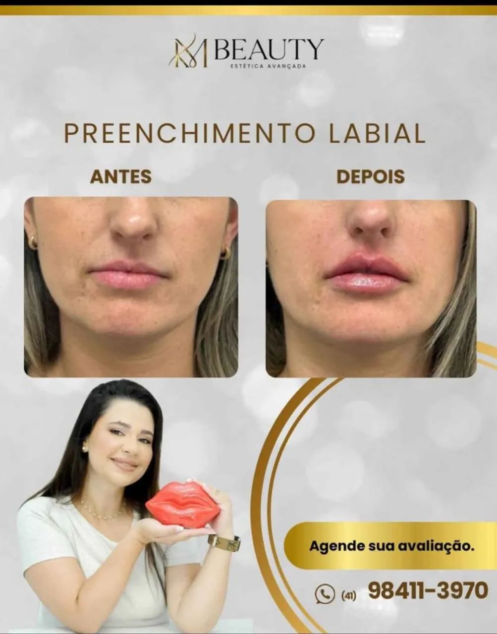 Preenchimento labial