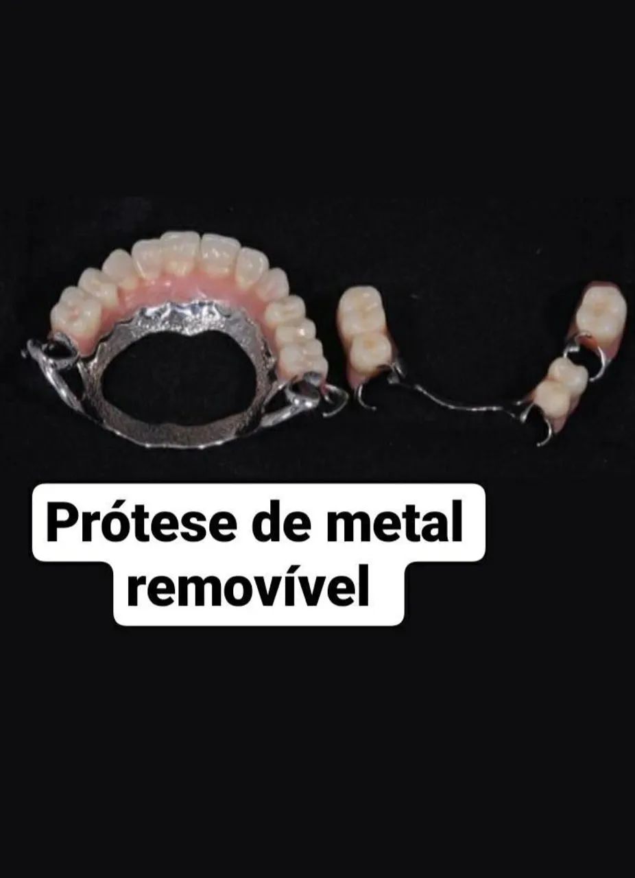 Prótese Dentária  - Foto 2