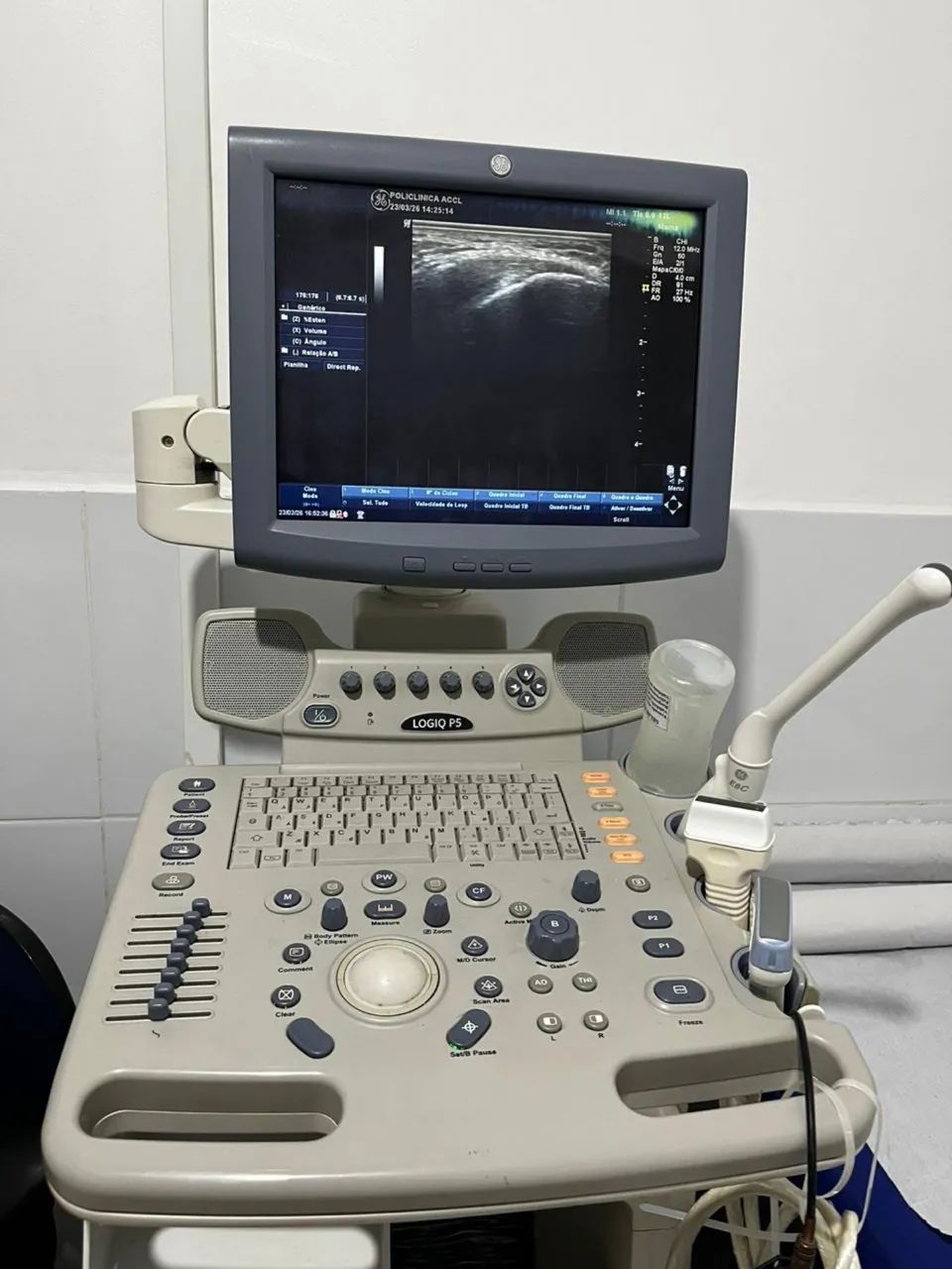 Vendo aparelho ultrassom ultrassonografia Logic P5 - Foto 6