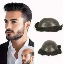 Prótese Capilar Masculina - Foto 3
