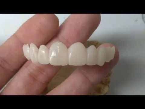 Prótese Dentária  - Foto 3
