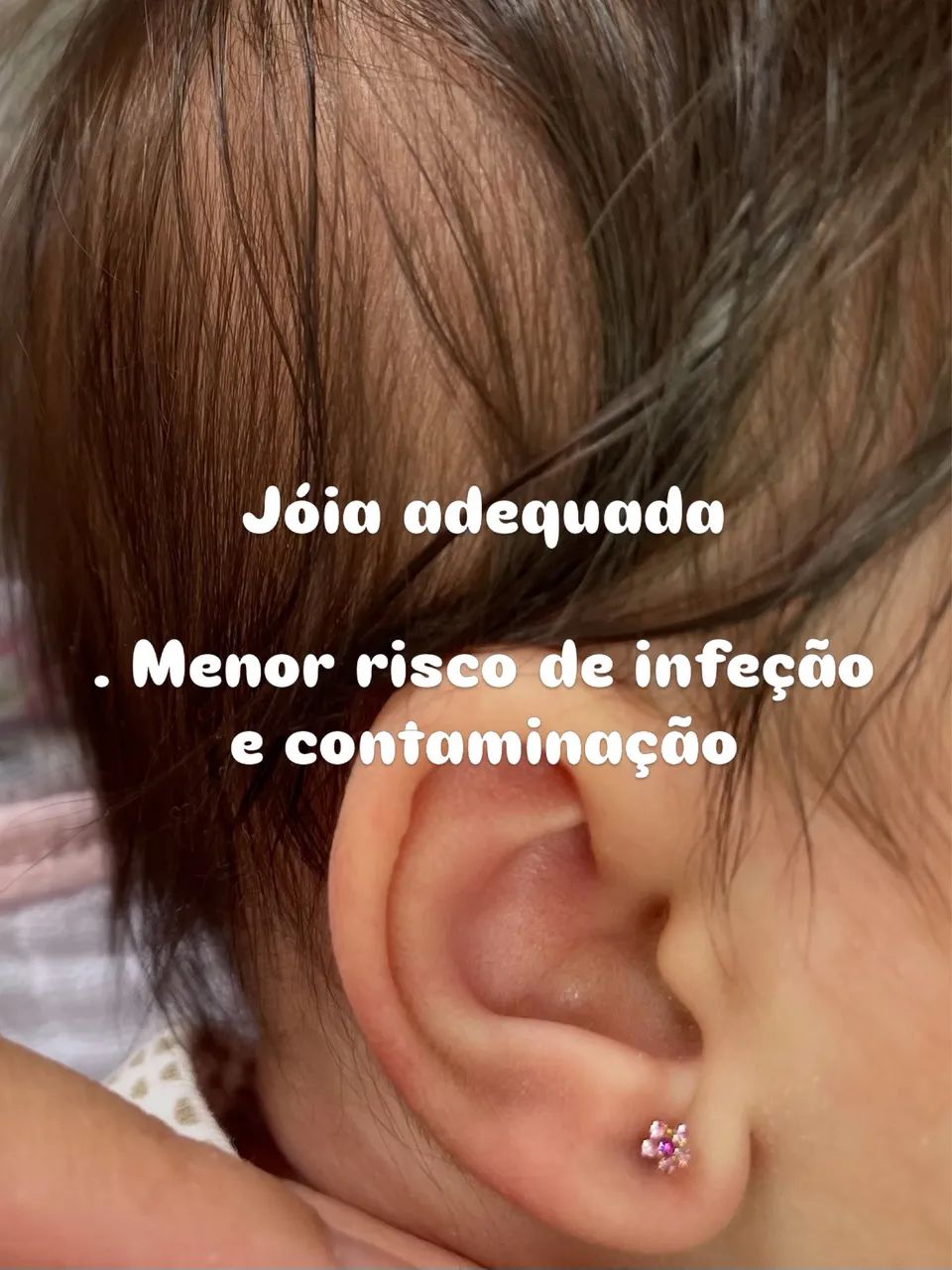 Furo humanizado de orelha - Foto 2