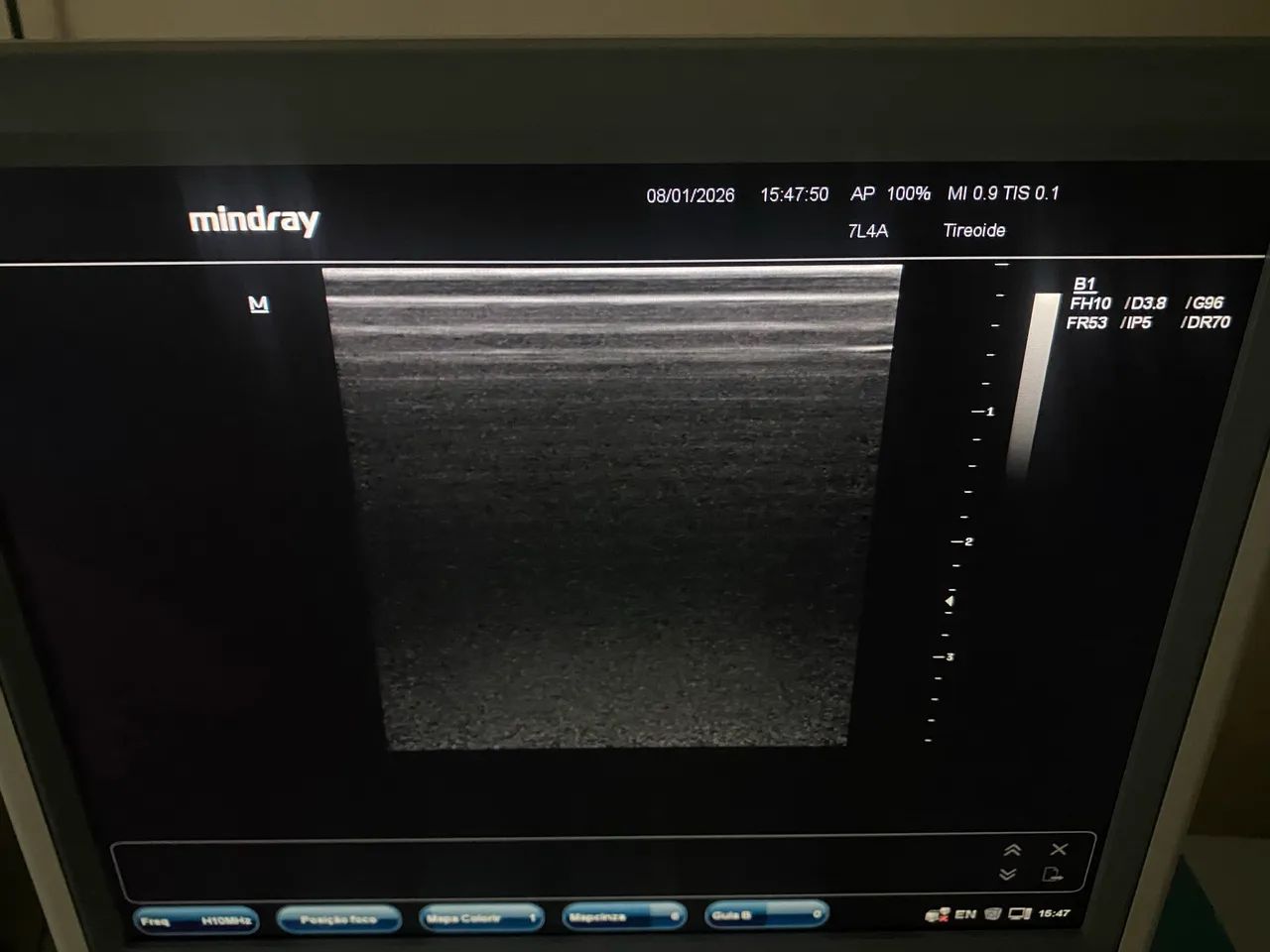 Ultrassom Mindray DC7 - Foto 5