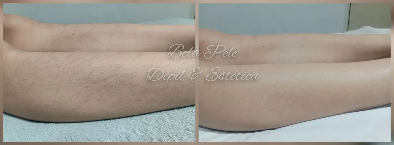 Depil e Estética FEM. / MAS. - Foto 2