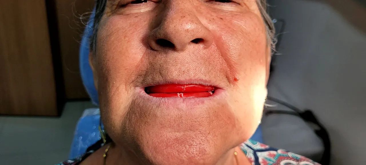 Dor de Dente  - Foto 4