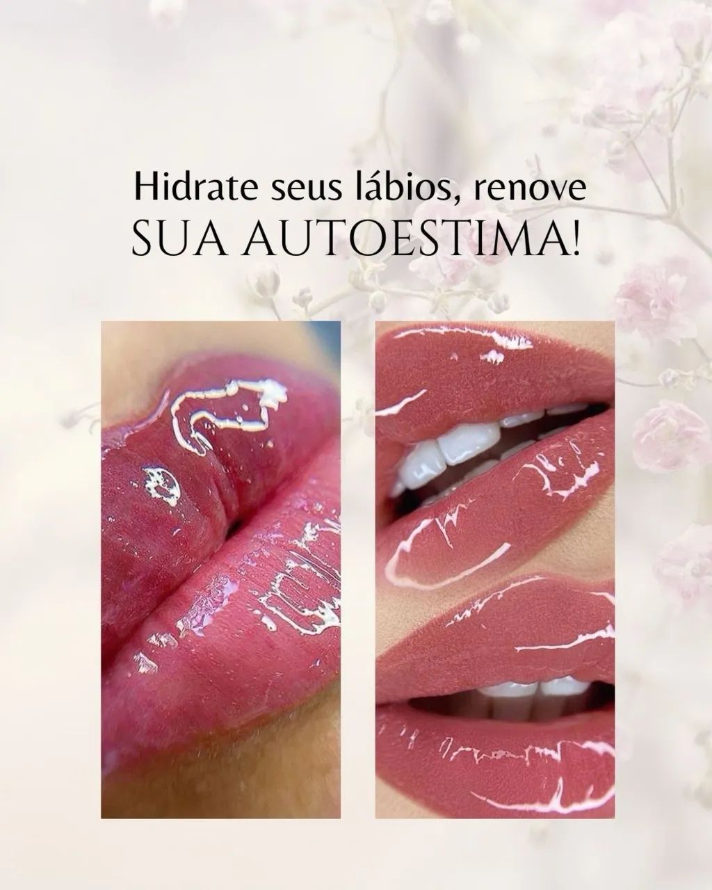Limpeza de pele + Spa dos lábios  - Foto 2