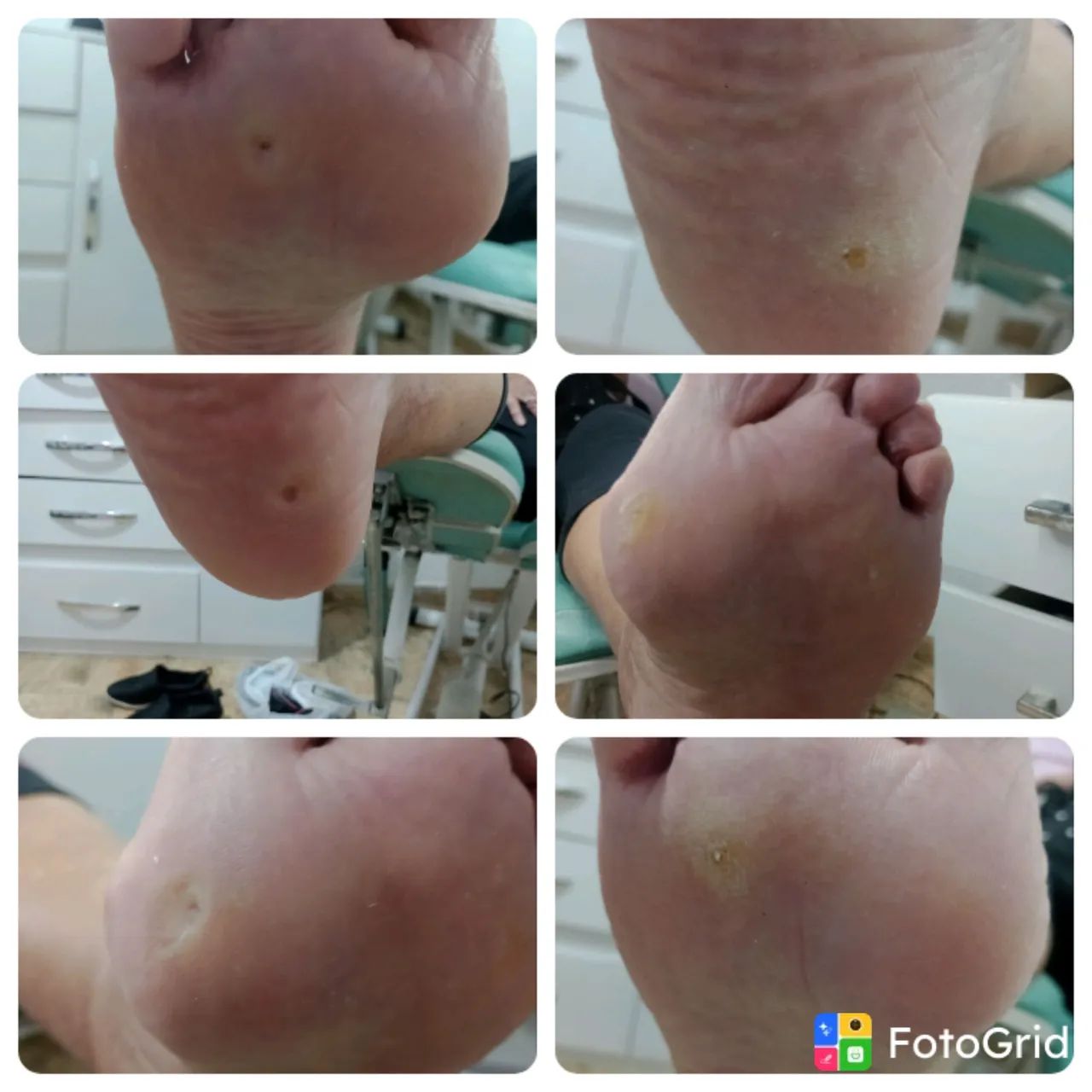 Podóloga atendimento domiciliar watss * - Foto 4