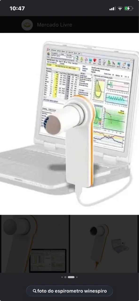 Espirômetro/ Espirometria  - Foto 2