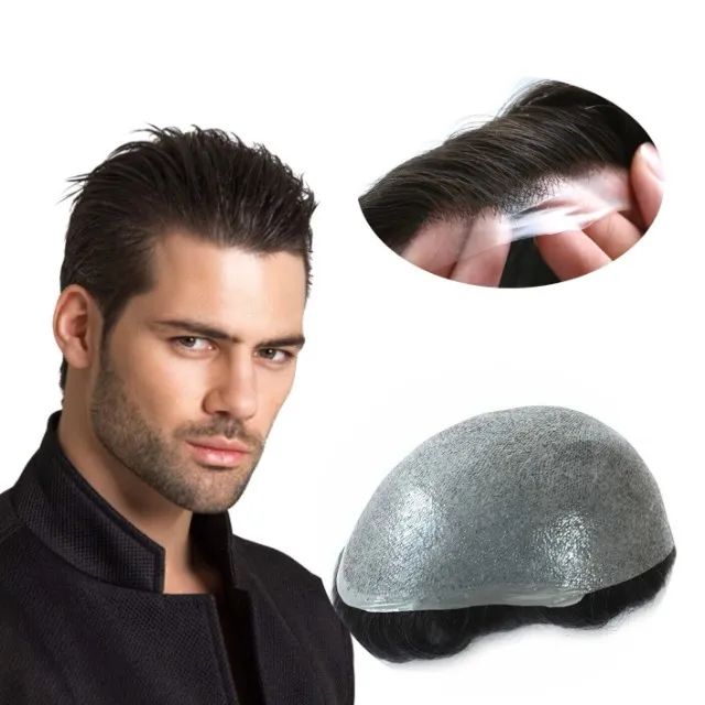 Prótese Capilar Masculina - Foto 4