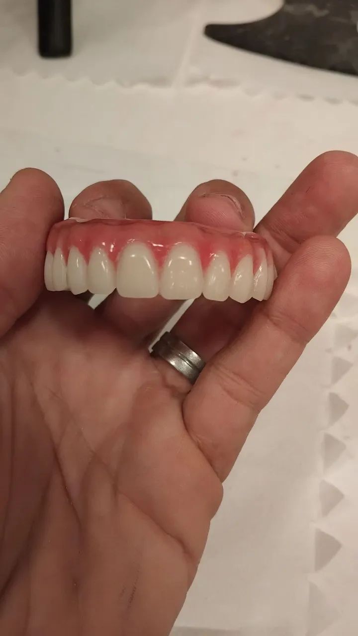 Prótese dentária  - Foto 3