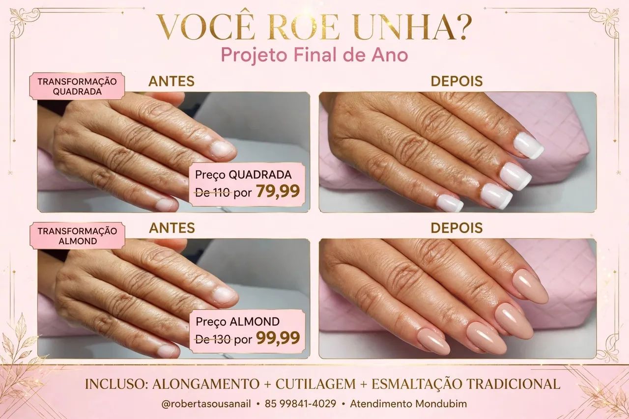 Você tem unhas roidas?