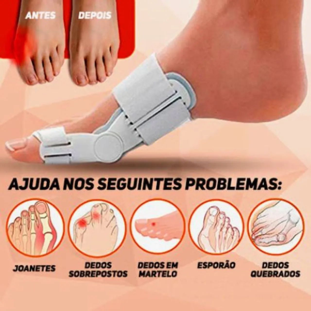 Alívio para Joanete, Dedos Sobrepostos, Dedos em Martelo, Esporão e Dedos Quebrados