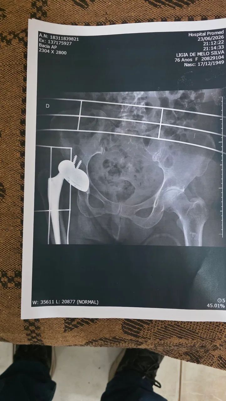 Fisioterapia Domiciliar 