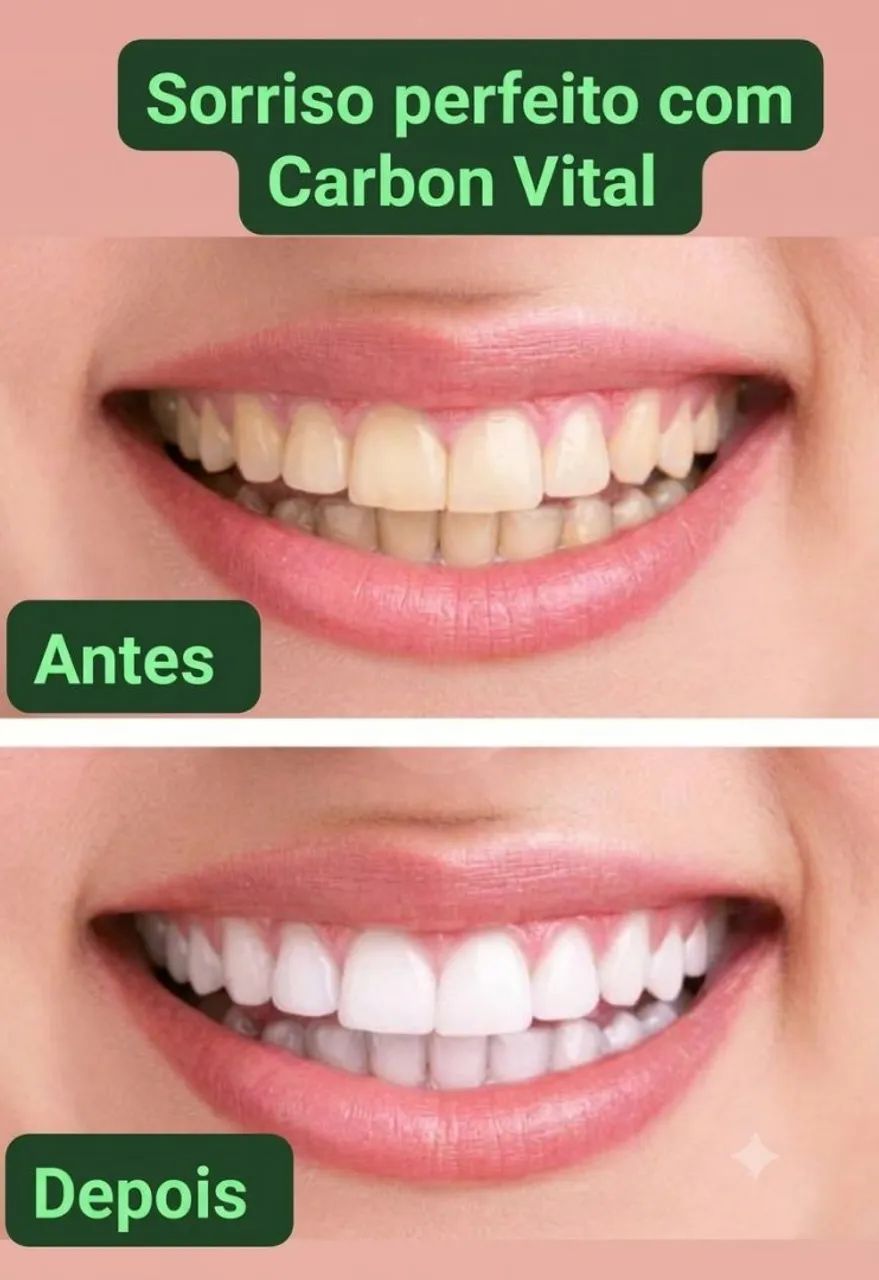 Clareador dental eficaz - Foto 3