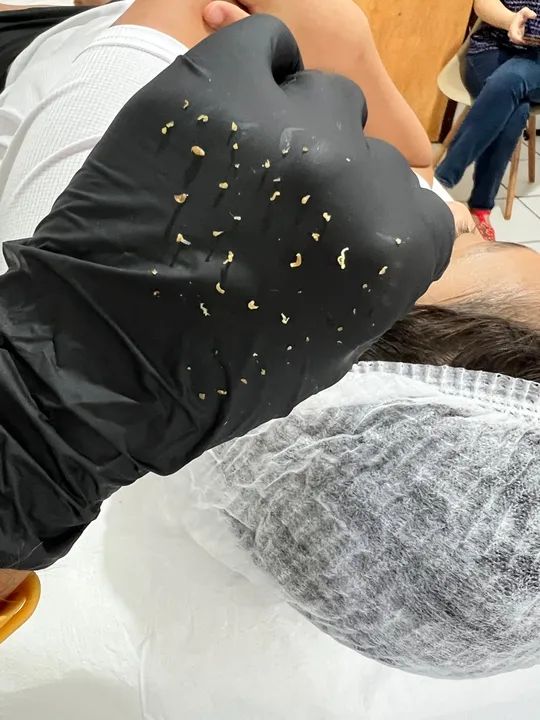 Limpeza de pele Enzimática