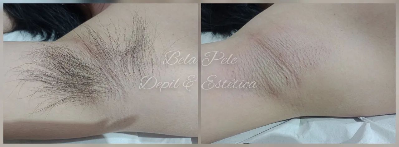 Depil e Estética FEM. / MAS. - Foto 3