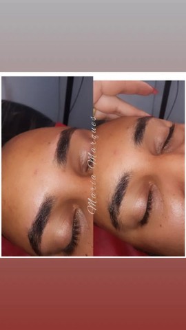 Depilação feminina e masculina - Foto 2