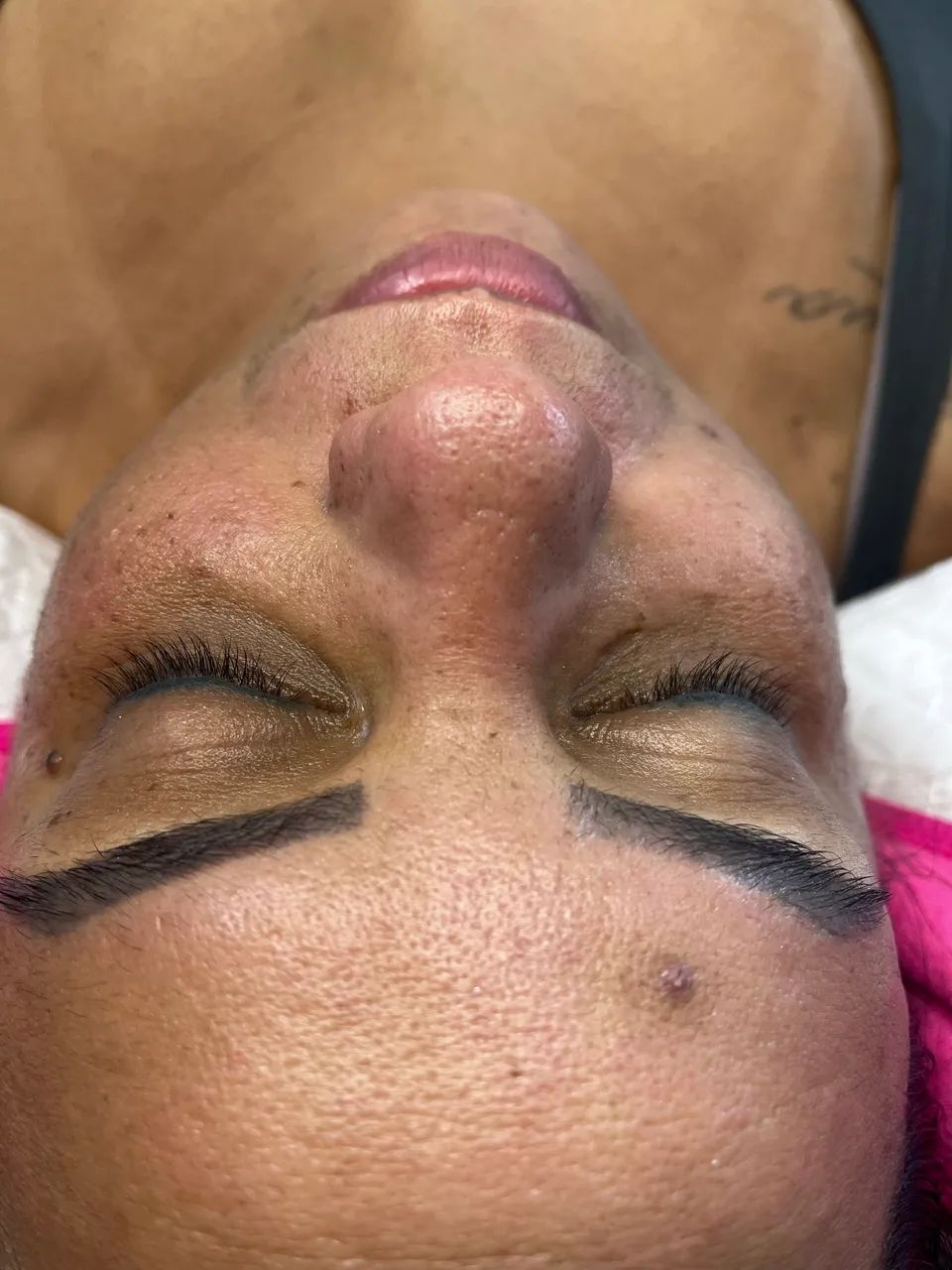 Limpeza de pele profunda completa  - Foto 4
