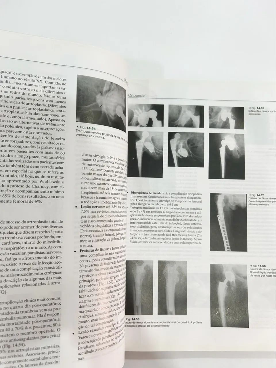 Ortopedia e Traumatologia 4ª Ed. - Foto 4