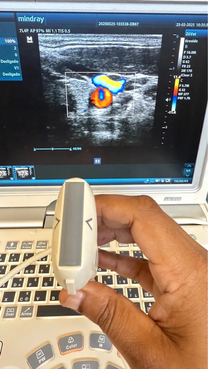 Ultrassom Mindray Z6 - Foto 5