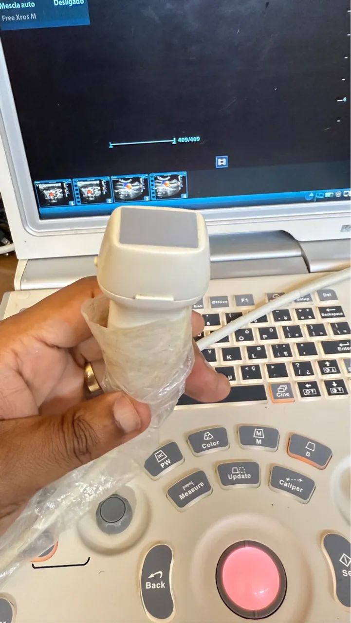 Ultrassom Mindray Z6 - Foto 3