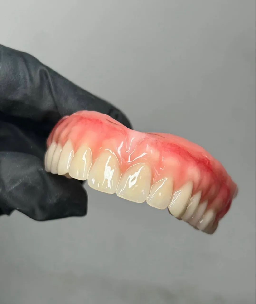 Prótese dentária 