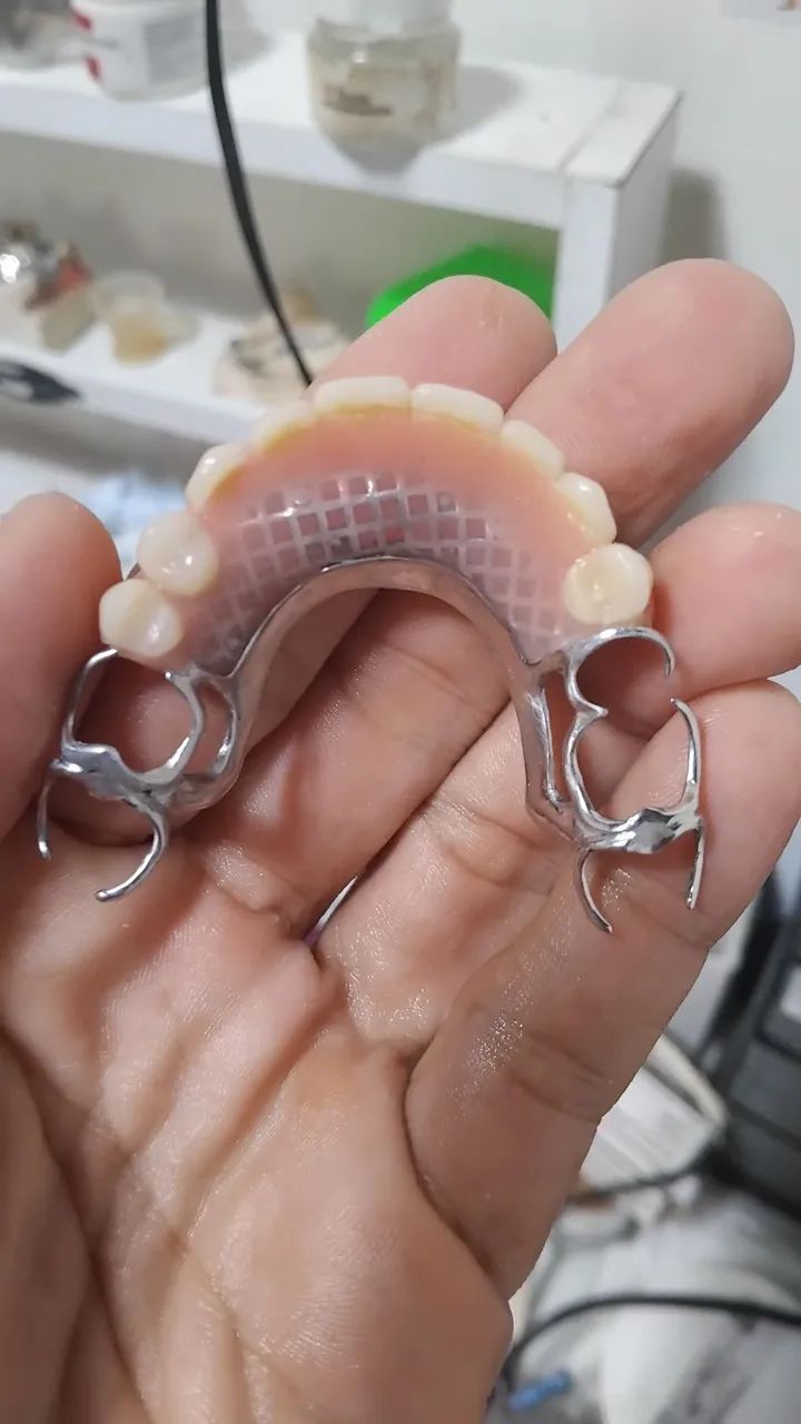 Prótese dentária  - Foto 4