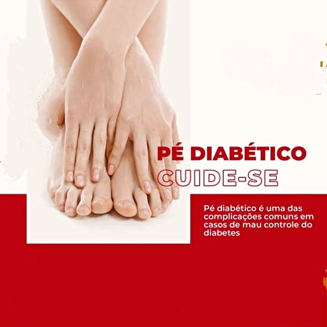Unha Encravada? - Tratamento Podológico - Foto 5