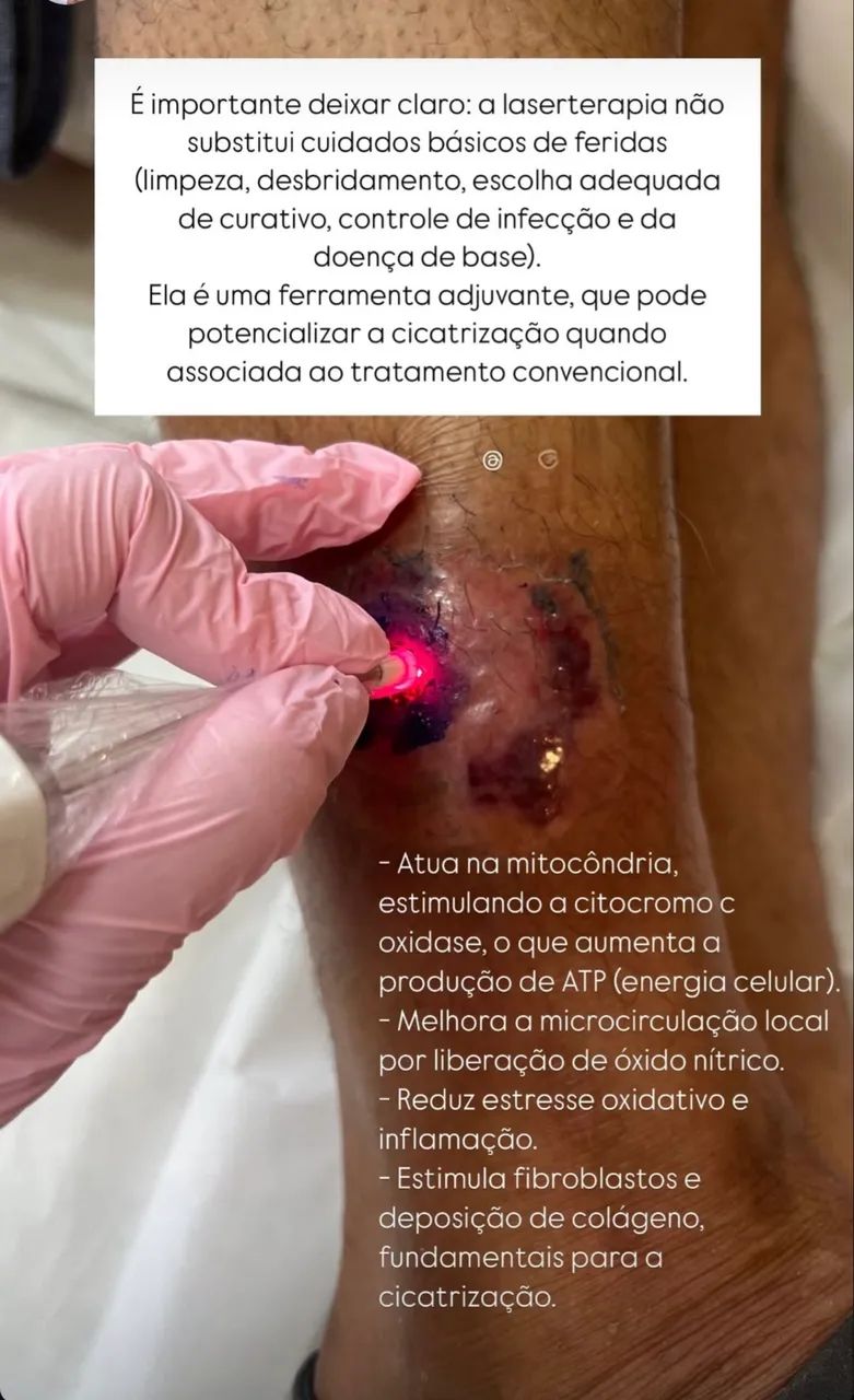 Enfermeira Curativos Laser - Foto 5