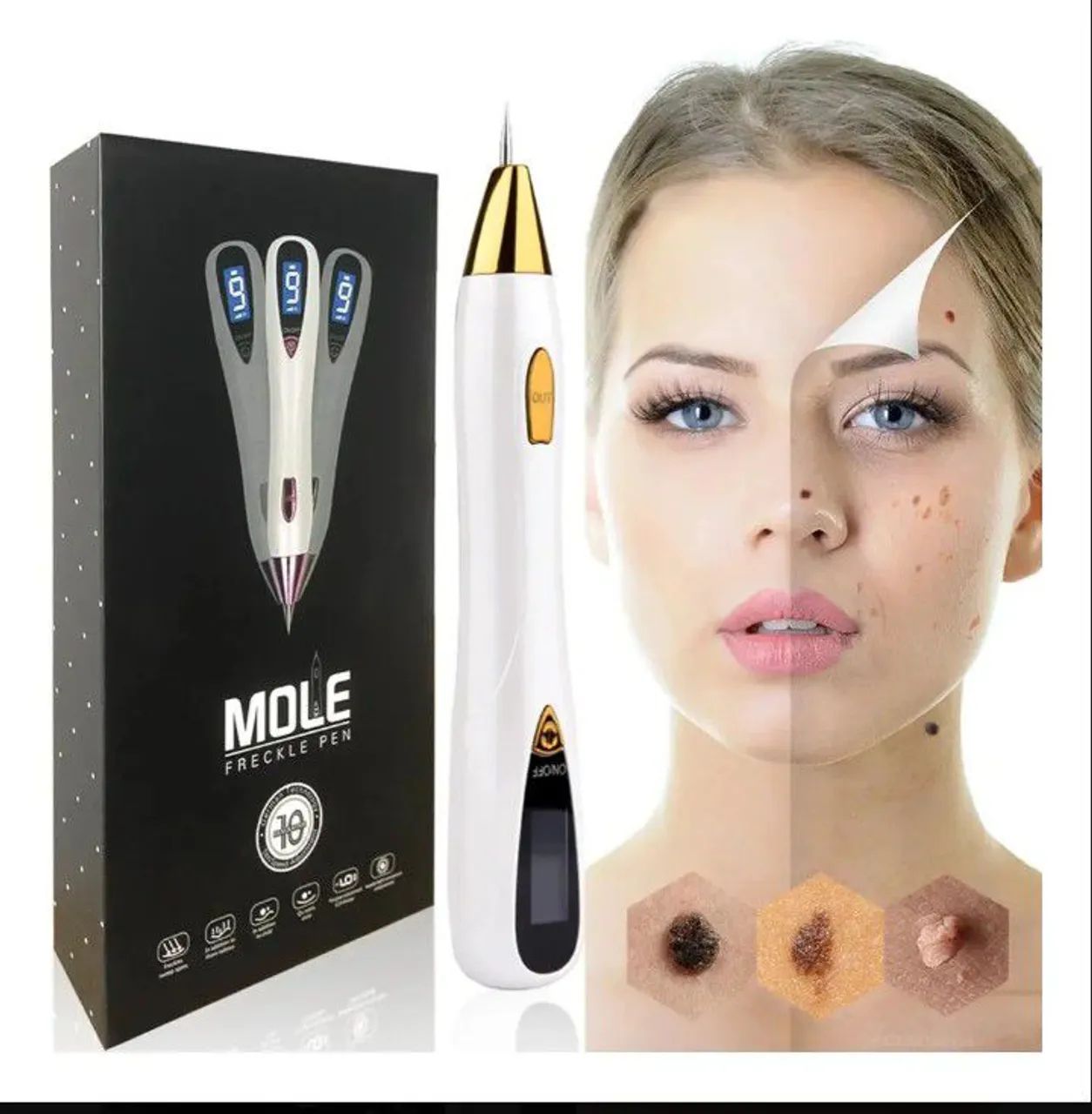 Mole freckle pen9 - Foto 2