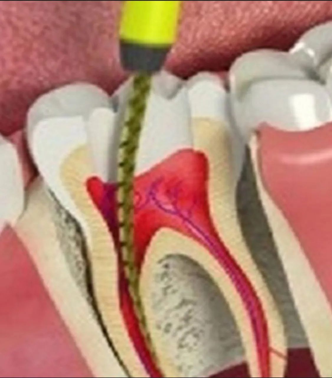 Endodontista  - Foto 2
